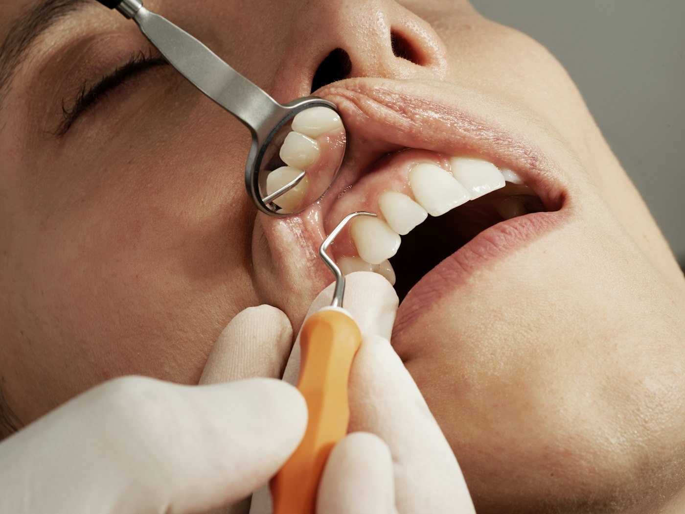 Patient reclining during a gentle dental procedure